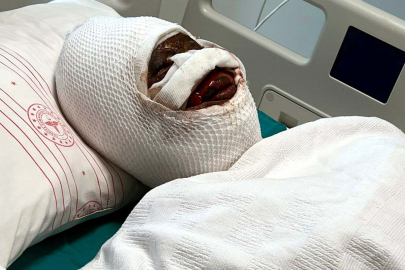 Eşini koli bandı ile bağlayıp, başından aşağı kezzap döktü