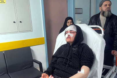 Boşanmak isteyen kadına kaldırım taşıyla dehşet: Yoğun bakıma alındı